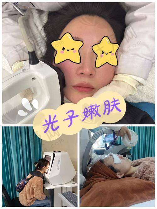 大连沙医生皮秒激光+M22超光子全模式的出色技术水平