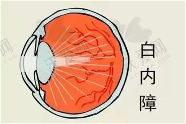 保定新视眼科白内障眼力健ICB00增强型单焦晶体5800元起，申文辉院长助力优化中距视力