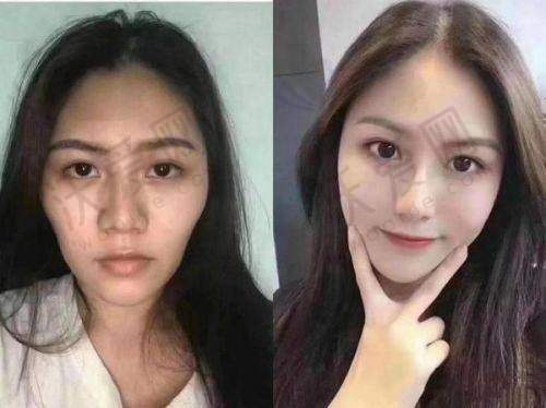 总结——北京美莱医疗美容医院田鹏医生怎么样？