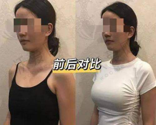 北京美莱医疗美容医院于双全医生口碑评价如何？
