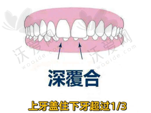 广州广大口腔的种牙技术精良在哪里？
