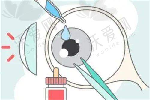 武汉地区配镜价格情况