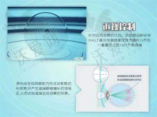 江苏省徐州市第一人民医院（眼科）滕操犁医生技术好不好？