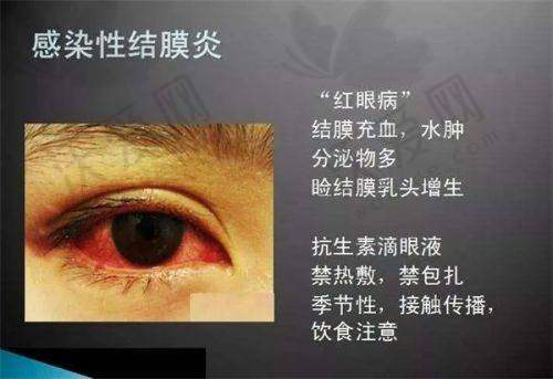 保定新视眼科在白内障治疗方面有什么特色？