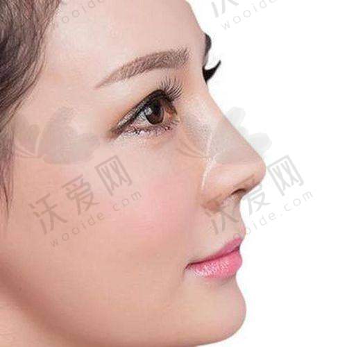 深圳阳光整形是一家怎样的医院？