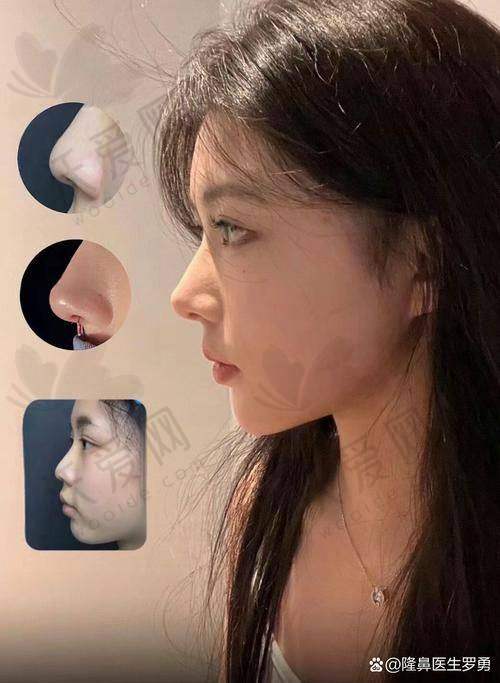 总结——北京米扬丽格医疗美容门诊部巫文云医生怎么样？