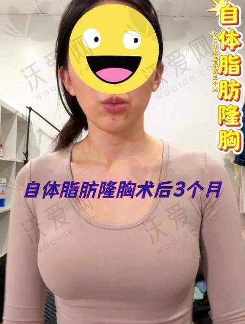 深圳阳光整形医院自体脂肪隆胸技术有哪些优势？