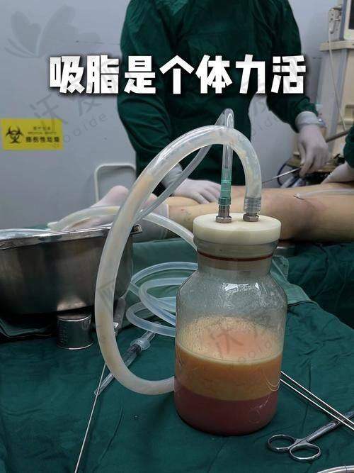 北京美莱医疗美容医院王志强医生技术好不好？