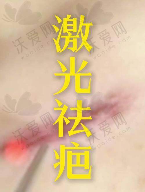兰州军区总医院整形科去疤痕骨干医生有哪些？