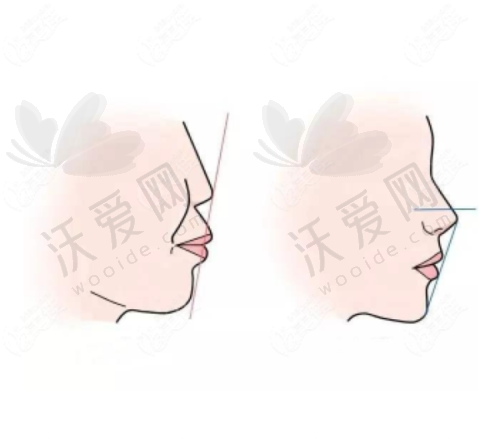 2025新乡市口碑好的牙科医院排名之新乡小白象口腔
