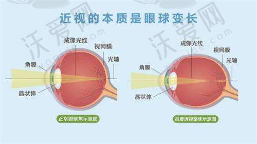 四川省人民医院（眼科）技术好不好？