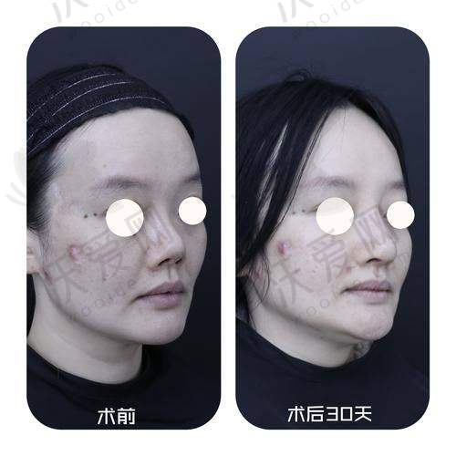 北京美莱医疗美容医院牛永敢医生挂号预约攻略