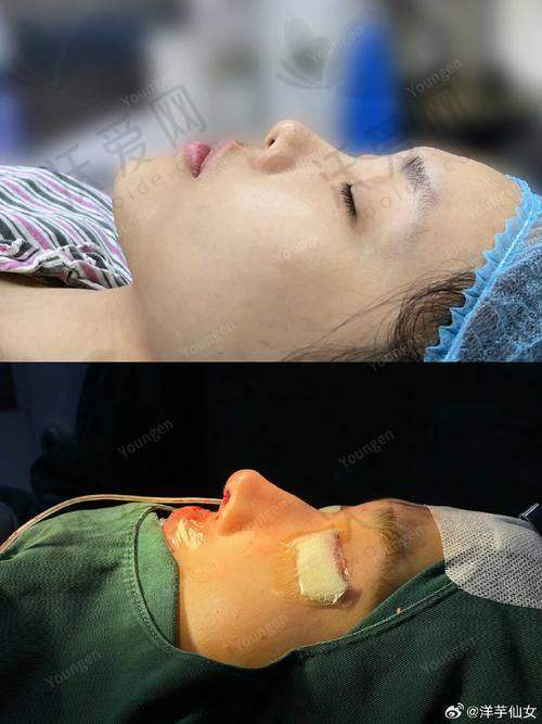 北京美莱医疗美容医院牛永敢医生技术好不好？