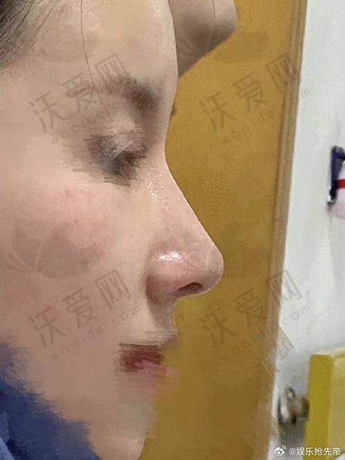 北京美莱医疗美容医院牛永敢医生个人简介