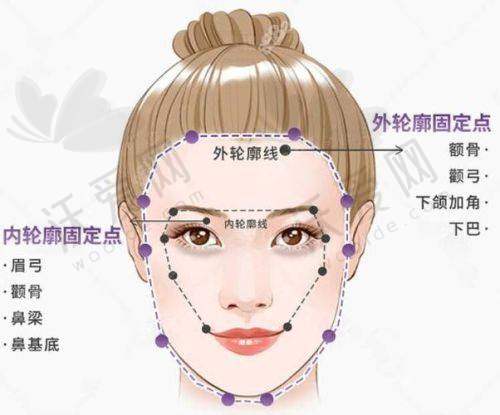 骨水泥颅顶填充术风险提醒