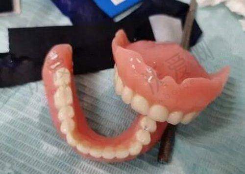成都团圆口腔医生怎么样？专精耐心值得信赖