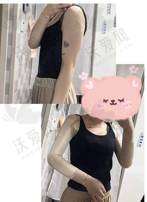 韦元强医生在北京联合丽格第二医疗美容医院如何预约