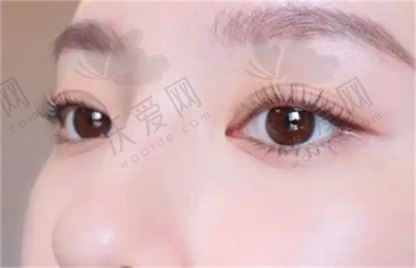 上海首尔丽格韩莉亚第四代热玛吉眼周450发1.35万起专人专头，淡化细纹紧致肌肤速恢复！