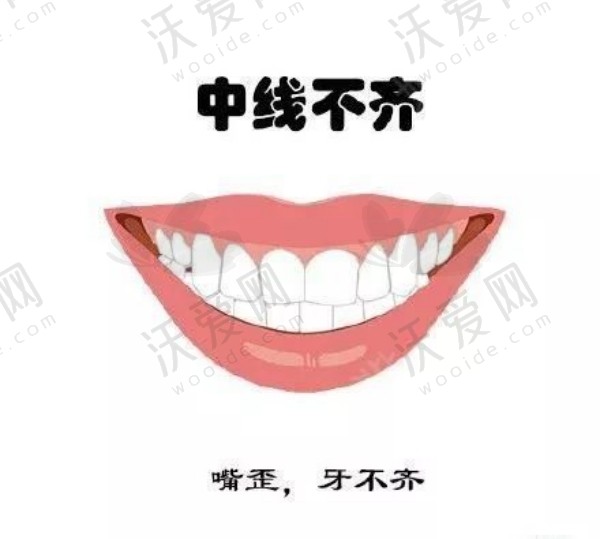 南阳矫正牙齿费用多少钱？百乐、植得、康泽三家医院各有啥正畸亮点？
