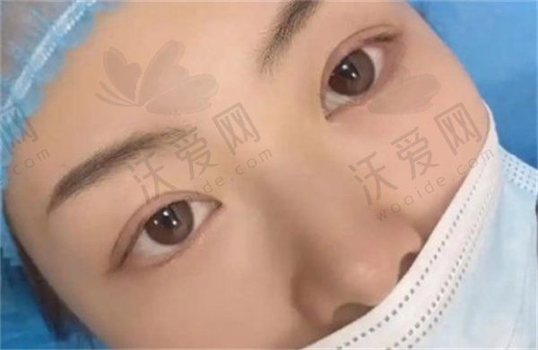 深圳阳光整形眼周Fotona4DPro原价8800元现989元起，立体抗衰成效更惊艳