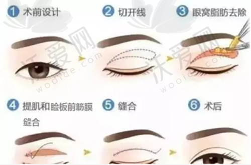 总结评价——深圳鸿瑞综合门诊部医疗美容科怎么样？