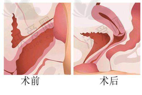 北京武警总医院美容科擅长项目