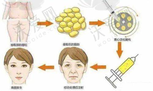 武汉亚韩整形外科医院收费标准参考