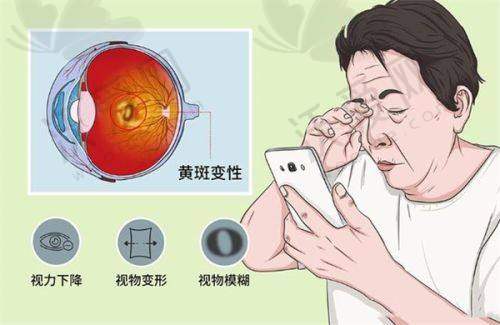 哈尔滨普瑞眼科医院成人医学配镜有哪些技术优势？