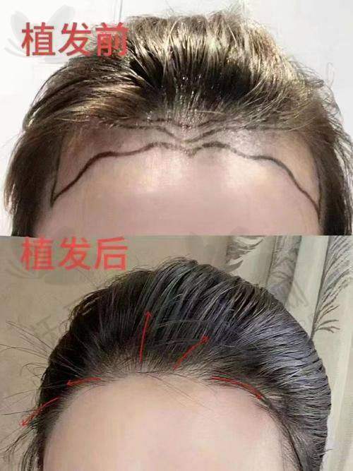 重庆艺星植发中 心介绍