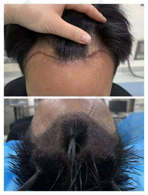 常州百年植发医疗美容诊所科室齐全！