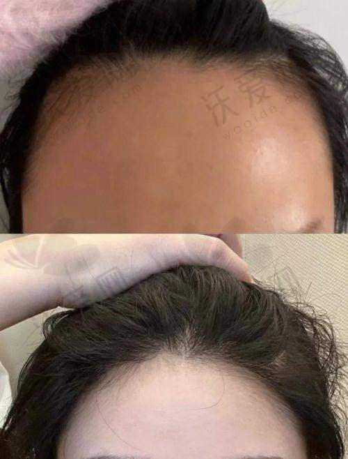 重庆碧莲盛植发医院介绍
