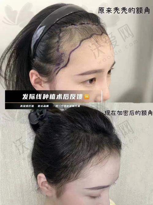 常州百年植发医疗美容诊所收费标准参考