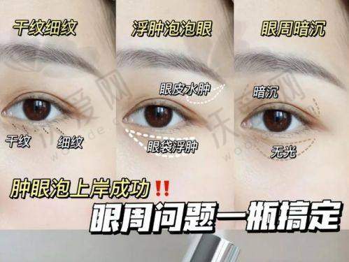 泉州西华医疗美容——老牌机构眼部除皱擅长