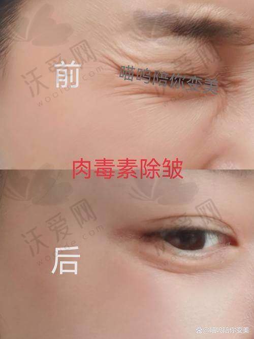 泉州美莱医疗美容——经验医生提供适合方案