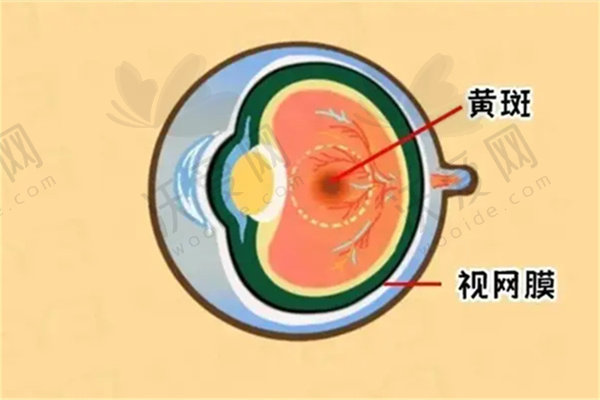 石家庄复明眼科郑云锋做视网膜脱离手术8500元起，微创精准个性化方案助您重见光明