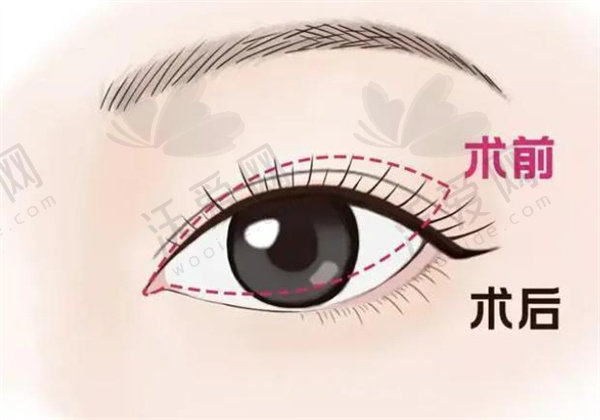 2025大连爱德丽格整形价格表更新！含双眼皮、祛眼袋、做鼻子等价格