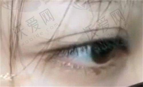 北京画美整形电话地址连连看！更有医院详情、路线及各项目主推医生介绍