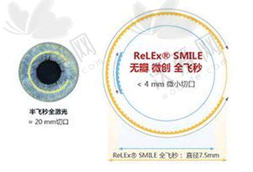 湛江爱尔奥理德眼科干眼症强脉冲光OPT治疗有风险吗？需要注意什么呢？