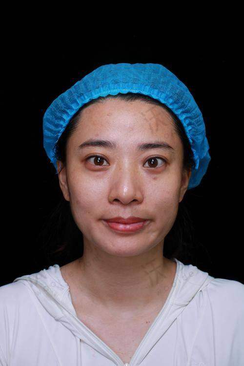 南宁健丽医美去眼袋真的靠谱吗？拥有正规资质、特色技术、亲民价格与良好口碑