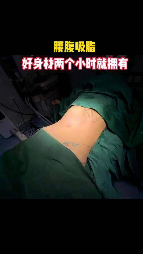 深圳阳光整形酷塑2.0单部位吸脂原价2800元，现2188元起享技术与服务双保障