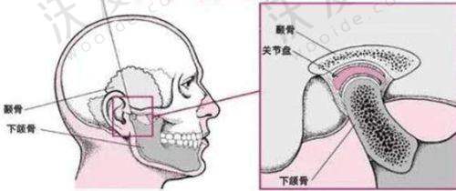 北京何照华医生磨骨手术真实评价大揭秘！多案例见证技术与审美双重实力