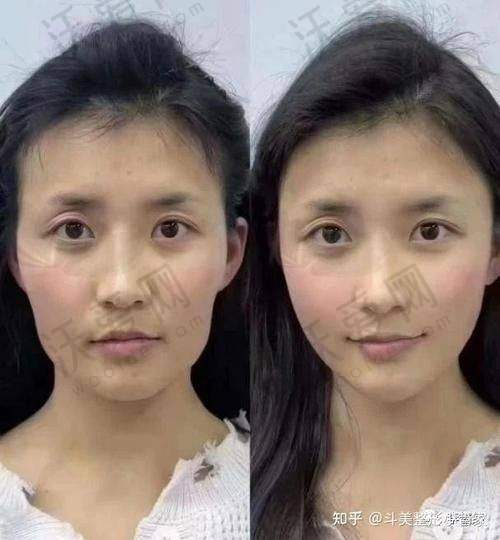 重庆星荣整形医院的实力怎么样？