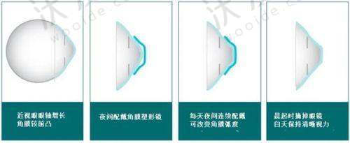 总结——天津市眼科医院王璐医生怎么样？
