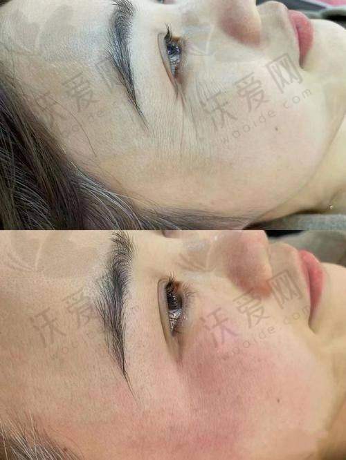 深圳阳光整形其他项目收费标准参考