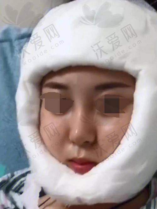 北京联合丽格第一整形医院何照华医生技术好不好？