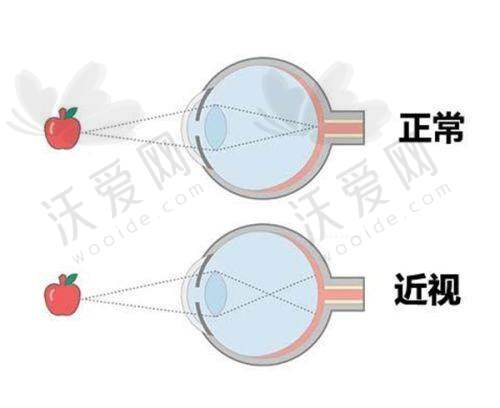 深圳爱尔眼科医生名单和简介里专注青少年近视防控的医生是谁？
