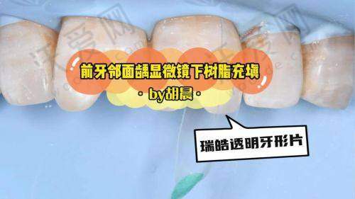 苏州美奥口腔的其他口腔项目收费标准参考