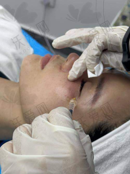 深圳阳光整形医院杏枝山浮光瓶活动总结