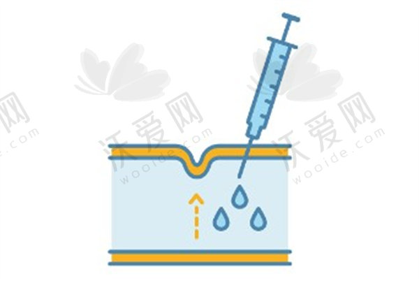杭州浮想国医美莫娜丽莎玻尿酸外轮廓提升原价6800元，优惠后3支现3190元起错过无！