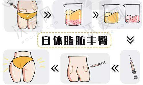 总结评价——石家庄星源美天医疗美容医院怎么样？